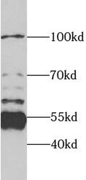 SPTLC1 Antibody