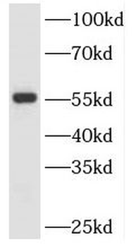 SPTLC2 Rabbit Polyclonal Antibody
