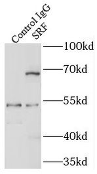 SRF Antibody