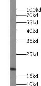 SRP14 Rabbit Polyclonal Antibody