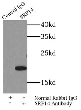 SRP14 Rabbit Polyclonal Antibody