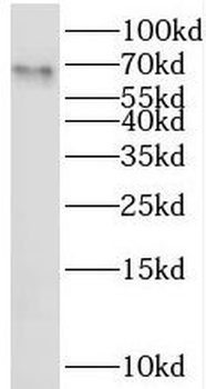 SRPRA Rabbit Polyclonal Antibody