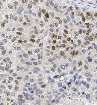 SRPRA Rabbit Polyclonal Antibody