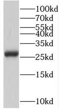 ZNRD2 Rabbit Polyclonal Antibody