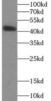 SSTR2 Antibody