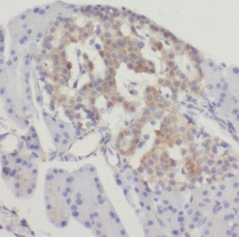 SSTR3 Rabbit Polyclonal Antibody