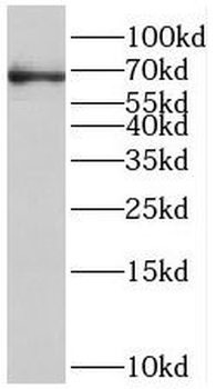 ST6GALNAC1 Rabbit Polyclonal Antibody