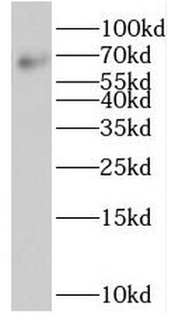 ST7 Rabbit Polyclonal Antibody