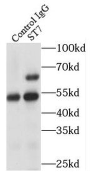 ST7 Rabbit Polyclonal Antibody