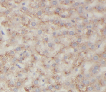 ST7 Rabbit Polyclonal Antibody