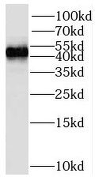 STAC Rabbit Polyclonal Antibody