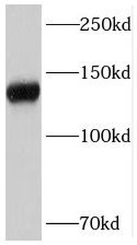 STAG2 Rabbit Polyclonal Antibody