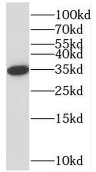 STARD10 Rabbit Polyclonal Antibody