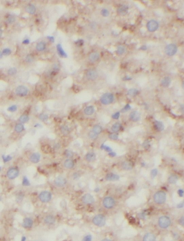 STARD10 Rabbit Polyclonal Antibody