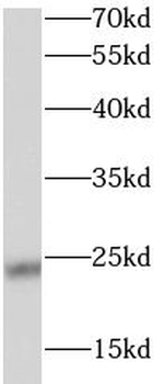 STARD5 Rabbit Polyclonal Antibody
