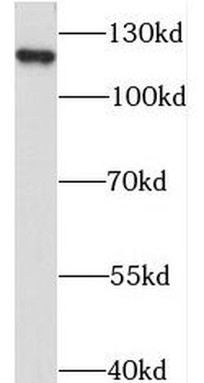STARD8 Rabbit Polyclonal Antibody