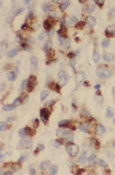 STARD8 Rabbit Polyclonal Antibody