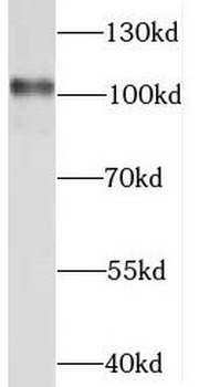 STAT6 Rabbit Polyclonal Antibody