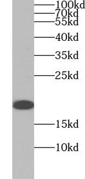 STMN1 Rabbit Polyclonal Antibody