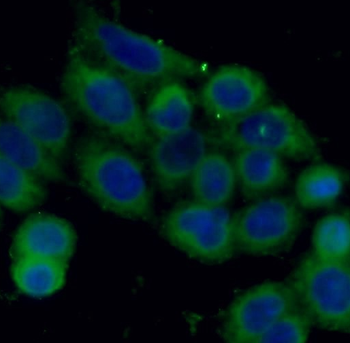 STMN1 Rabbit Polyclonal Antibody