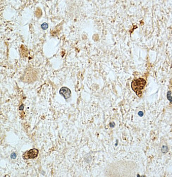 STMN1 Rabbit Polyclonal Antibody