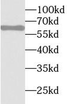 STAU1 Rabbit Polyclonal Antibody
