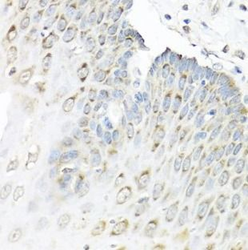 STAU1 Rabbit Polyclonal Antibody