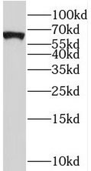 STAU2 Rabbit Polyclonal Antibody