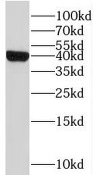 STEAP1 Rabbit Polyclonal Antibody
