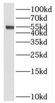 STEAP3 Rabbit Polyclonal Antibody