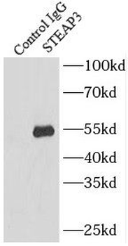 STEAP3 Rabbit Polyclonal Antibody