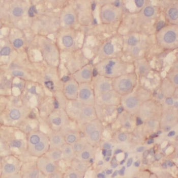 STEAP3 Rabbit Polyclonal Antibody