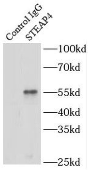STEAP4 Rabbit Polyclonal Antibody