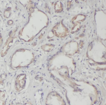 STEAP4 Rabbit Polyclonal Antibody