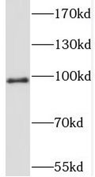 STIM2 Rabbit Polyclonal Antibody