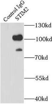STIM2 Rabbit Polyclonal Antibody