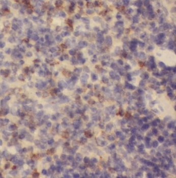 STIM2 Rabbit Polyclonal Antibody