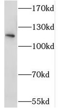 STK31 Rabbit Polyclonal Antibody