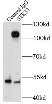 STK31 Rabbit Polyclonal Antibody