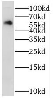 STK32C Rabbit Polyclonal Antibody