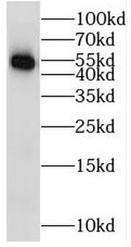 STK33 Rabbit Polyclonal Antibody