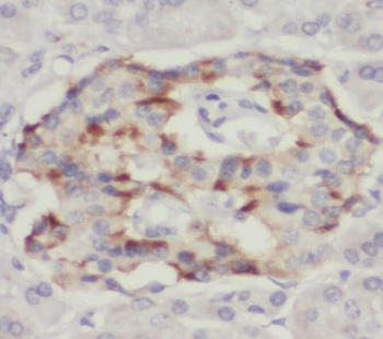 STK33 Rabbit Polyclonal Antibody