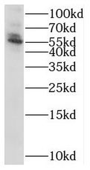 STK38 Rabbit Polyclonal Antibody