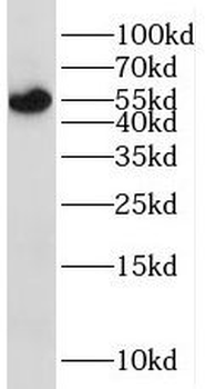 STK38 Rabbit Polyclonal Antibody