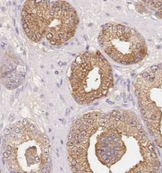 STK4 Rabbit Polyclonal Antibody