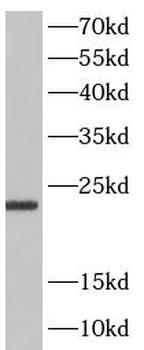 STMN2 Antibody