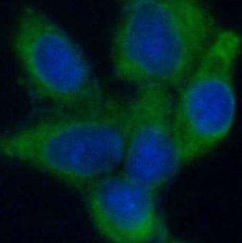 STOM Rabbit Polyclonal Antibody