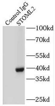 STOML2 Rabbit Polyclonal Antibody