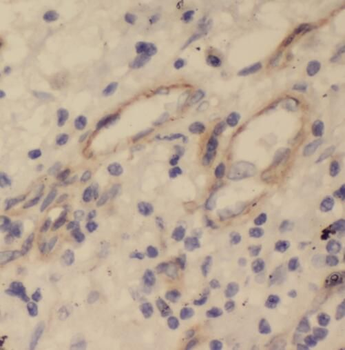 STOML2 Rabbit Polyclonal Antibody
