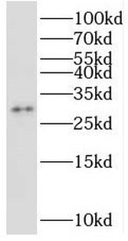 STOML3 Rabbit Polyclonal Antibody